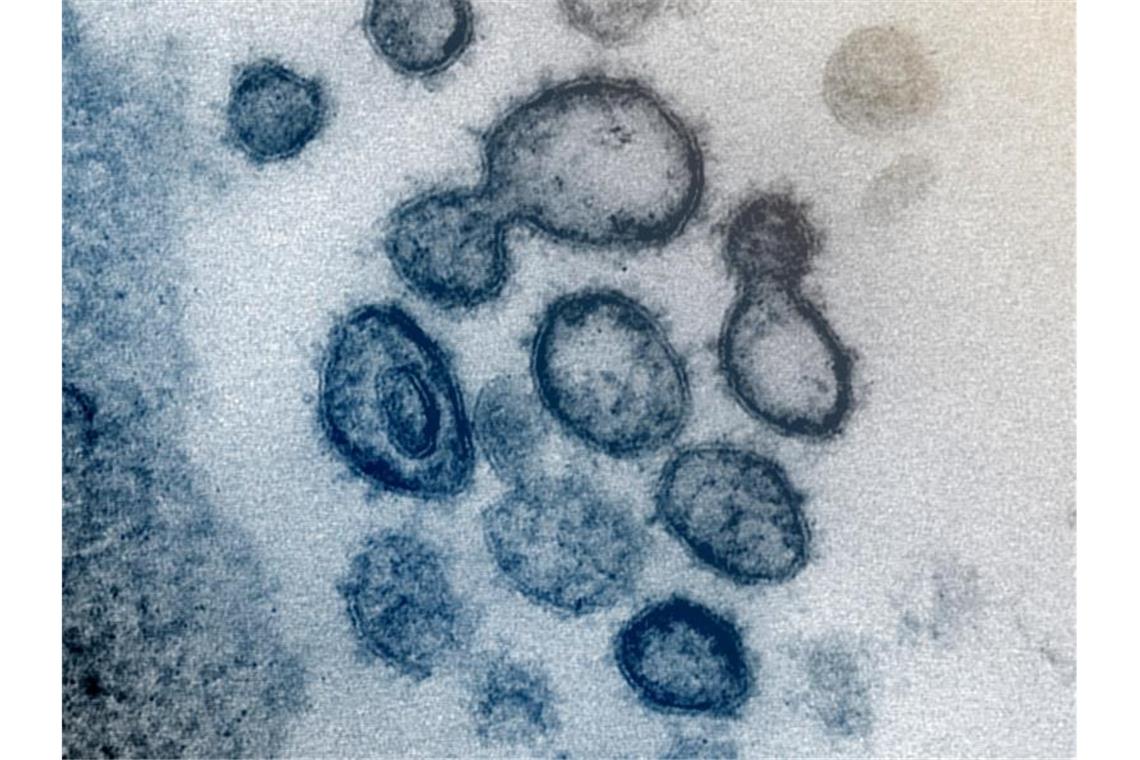 Eine Aufnahme eines Elektronenmikroskops zeigt das neuartige Coronavirus SARS-CoV-2. Foto: Uncredited/NIAID-RML/AP/dpa/Archivbild
