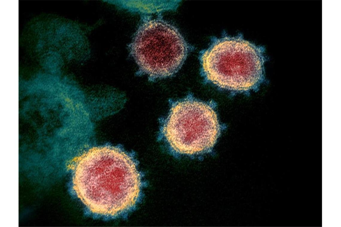 Eine Aufnahme zeigt das Virus, das COVID-19 verursacht. Foto: Uncredited/NIAID-RML/via Ap/dpa/Archivbild