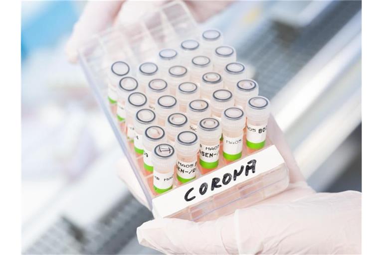 Eine biologisch-technische Assistentin hält ein Gefäß mit aufbereiteten PCR-Tests auf das Coronavirus in der Hand. Foto: Julian Stratenschulte/dpa/Symbolbild