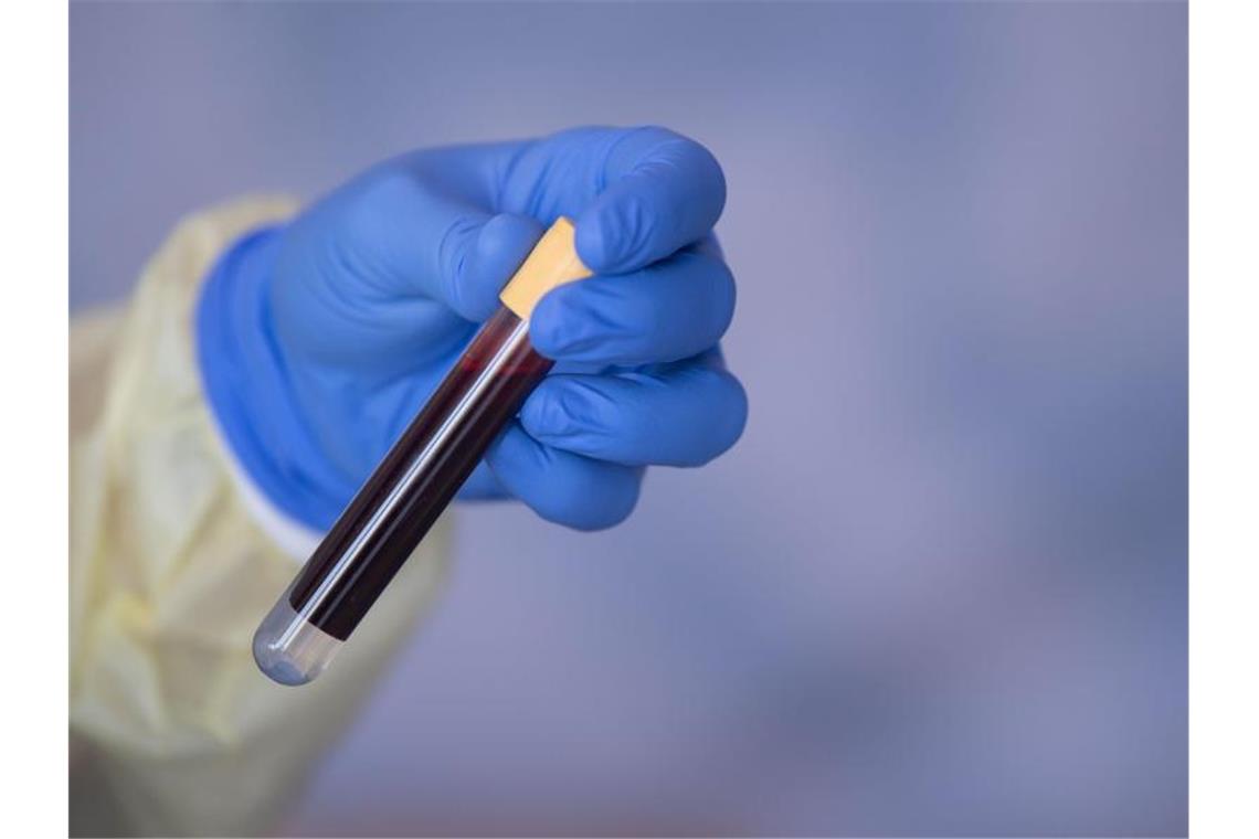 Eine Blutprobe für einen Antikörpertest beim RKI. Foto: Marijan Murat/dpa