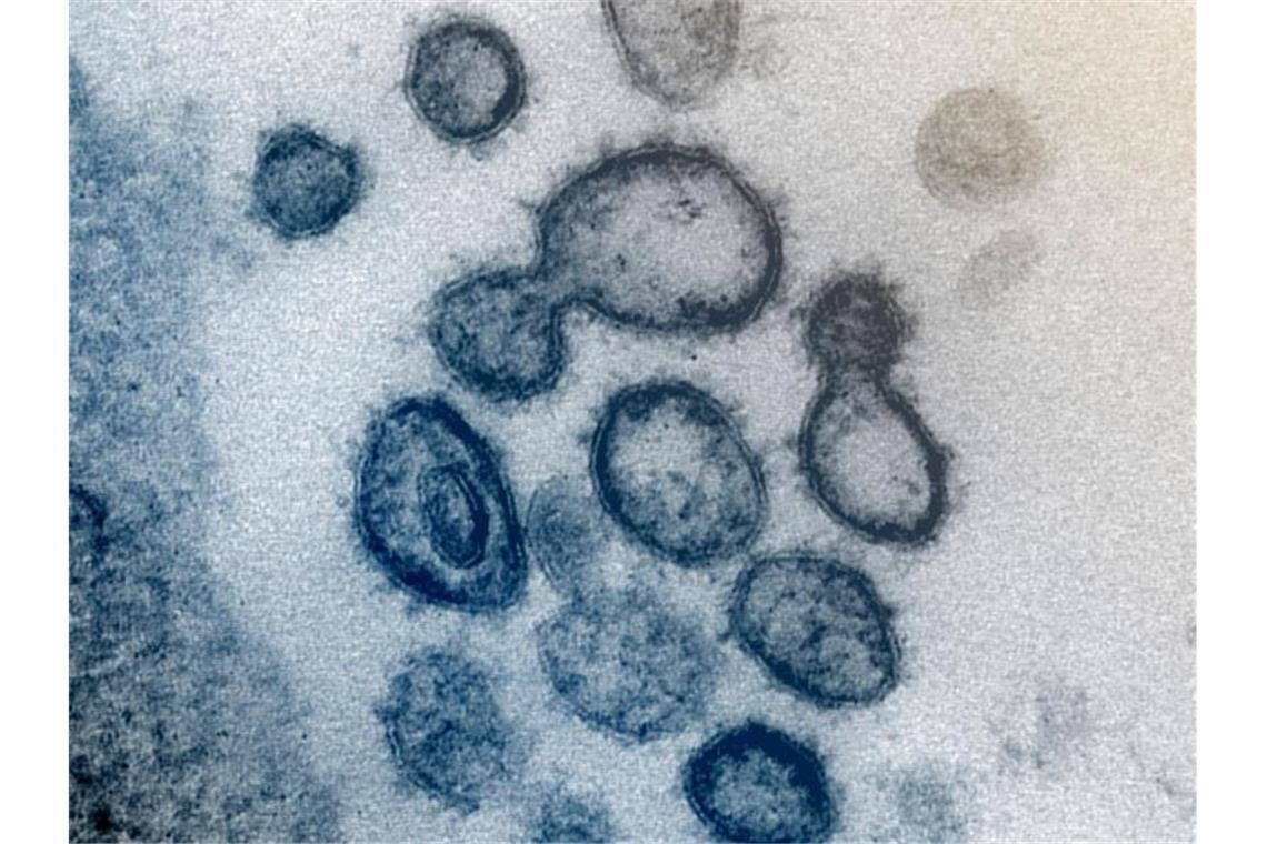 Eine elektromikroskopische Aufnahme zeigt das neuartige Coronavirus SARS-CoV-2. Foto: Uncredited/NIAID-RML/AP/dpa/Archivbild