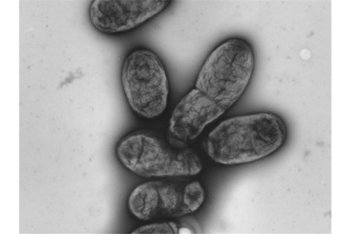 Eine elektronenmikroskopische Aufnahme zeigt das Pestbakterium Yersinia pestis. In China wurde der vierte Fall einer Pestinfektion innerhalb weniger Wochen gemeldet. Foto: -/Robert-Koch-Institut/dpa