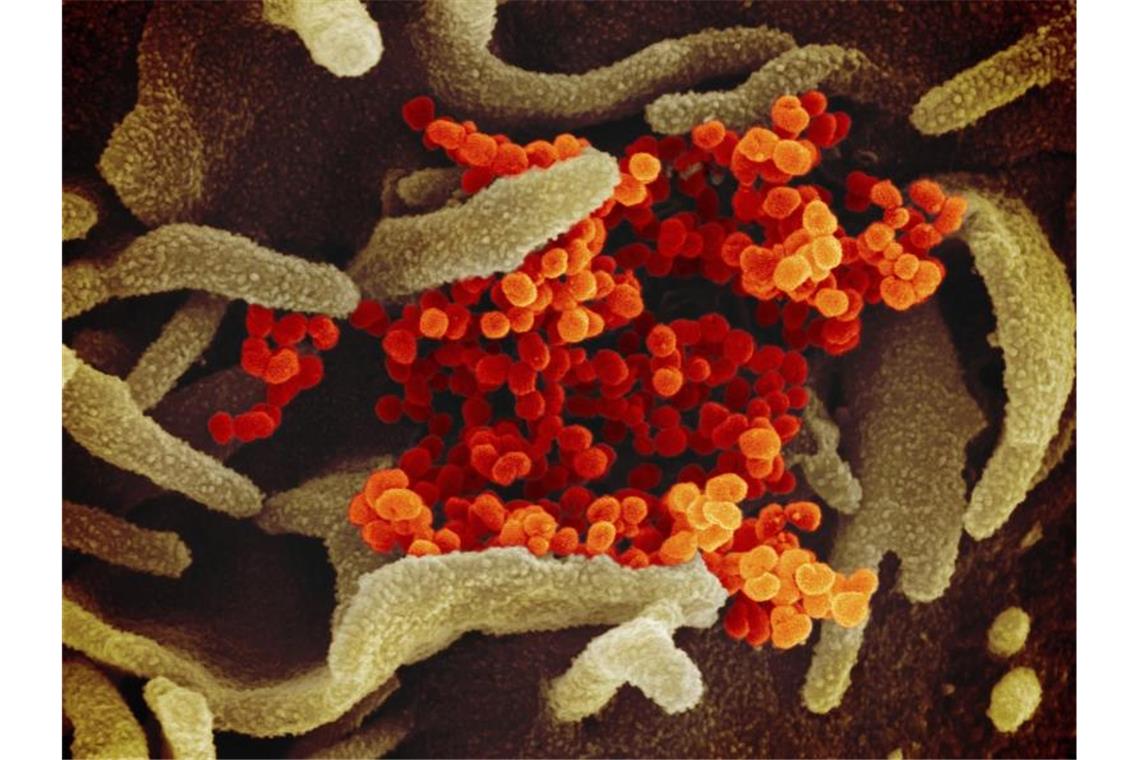 Eine elektronenmikroskopische Aufnahme zeigt das Coronavirus (SARS-CoV-2, orange), das aus der Oberfläche von im Labor kultivierten Zellen (grau) austritt. Foto: ---/NIAID-RML/dpa