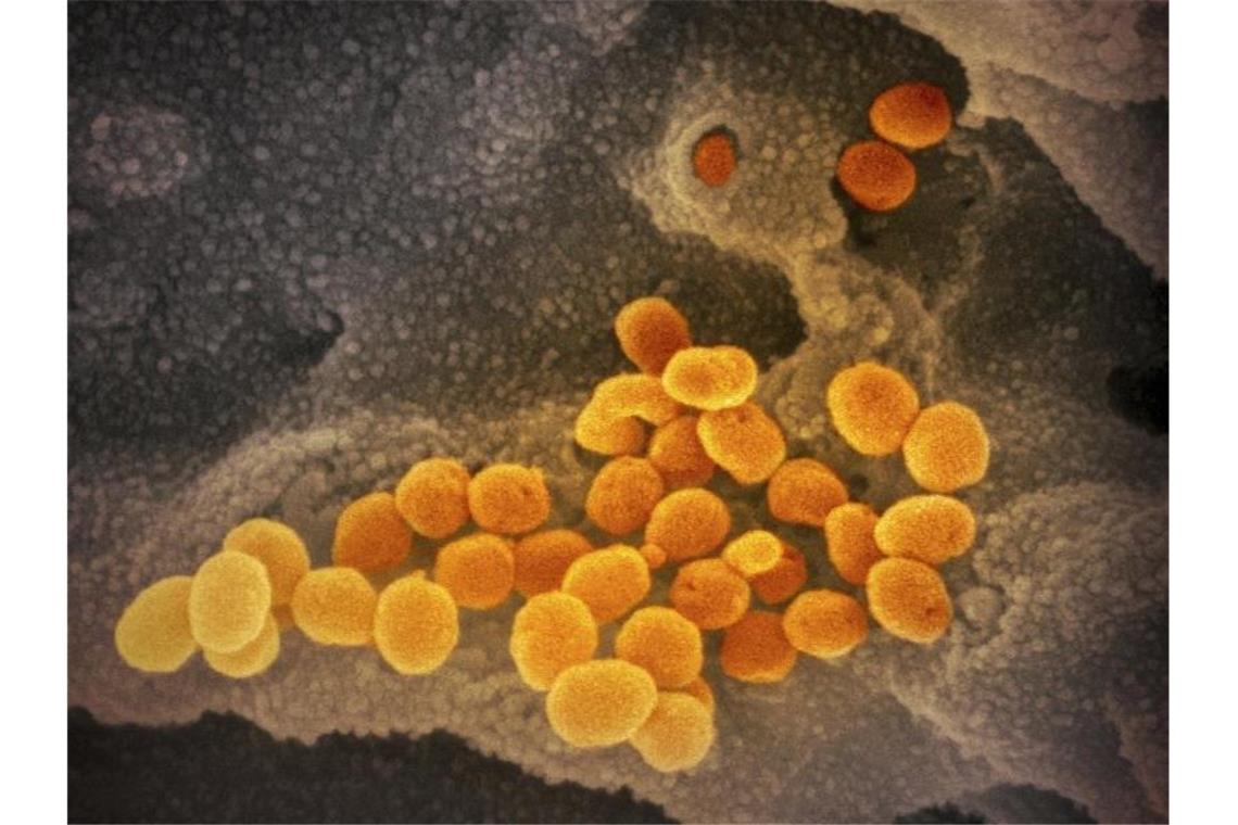 EU-Behörde prüft neues Covid-Medikament Eine elektronenmikroskopische Aufnahme zeigt das neuartige Coronavirus, das aus der Oberfläche von im Labor kultivierten Zellen austritt. Foto: NIAID-RML/AP/dpa