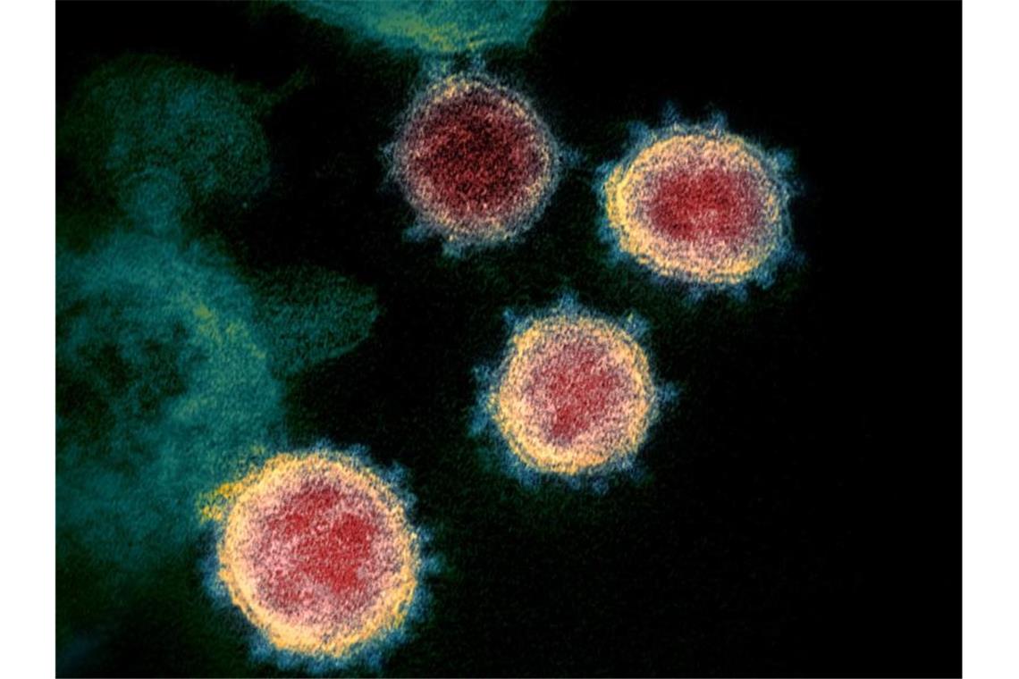 Eine elektronenmikroskopische Aufnahme zeigt das Virus, das Covid-19 verursacht. Foto: -/NIAID-RML/via AP/dpa/Symbolbild