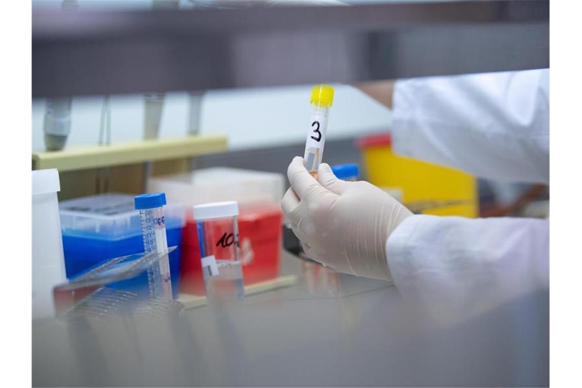 Eine Frau zeigt in einem Labor des einen Test für das neue Virus 2019-nCov. Foto: Sebastian Gollnow/dpa/Symbolbild
