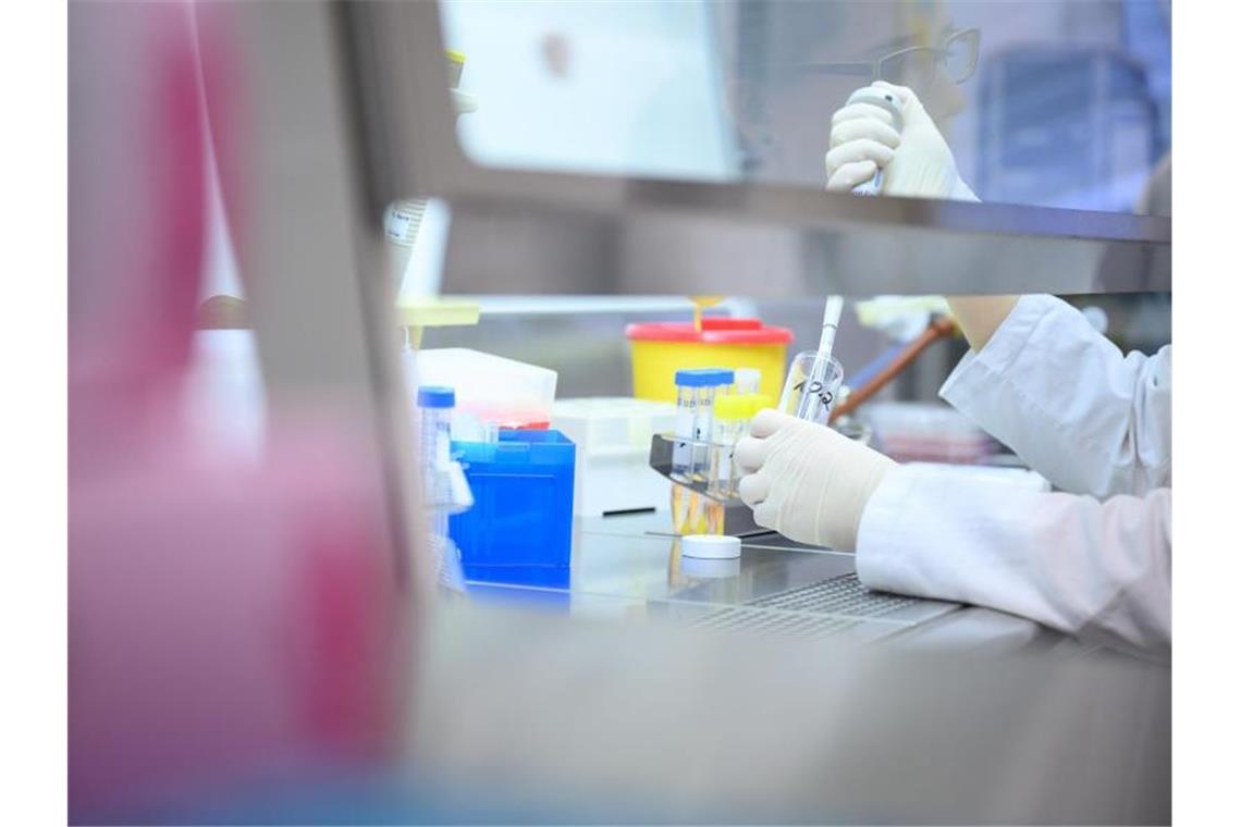 Eine Frau zeigt während eines Presserundgangs in einem Labor einen Test für das neue Virus 2019-nCov. Foto: Sebastian Gollnow/dpa/Archivbild