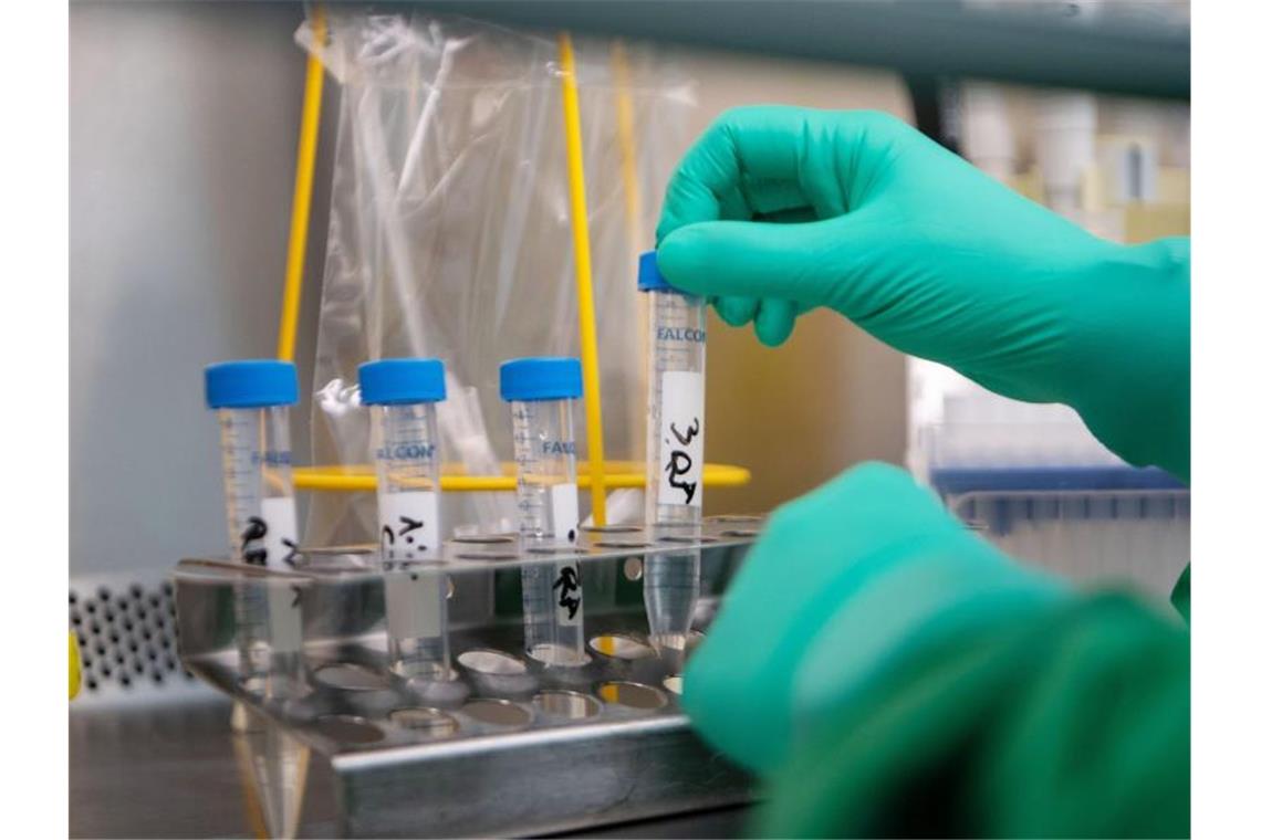 Coronavirus: Land schaltet im Krisenmodus einen Gang höher Eine inaktivierte Probe eines Covid-19-Verdachtsfalles in einer Vorrichtung. Foto: Marijan Murat/dpa/Archivbild