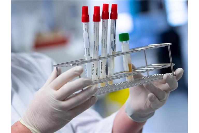 Eine Laborantin bereitet Corona-Proben für die weitere Analyse vor. Foto: Sven Hoppe/dpa/Archiv/Symbolbild