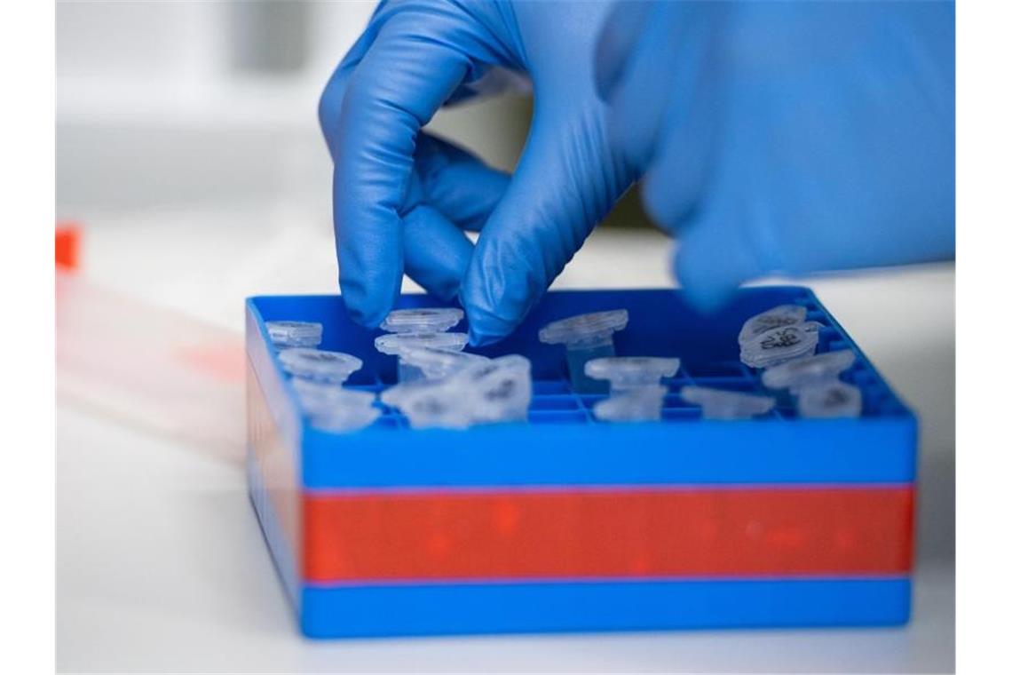 2402 Corona-Neuinfektionen in Baden-Württemberg Eine Laborantin führt Untersuchungen zum Coronavirus durch. Foto: Christophe Gateau/dpa/Symbolbild