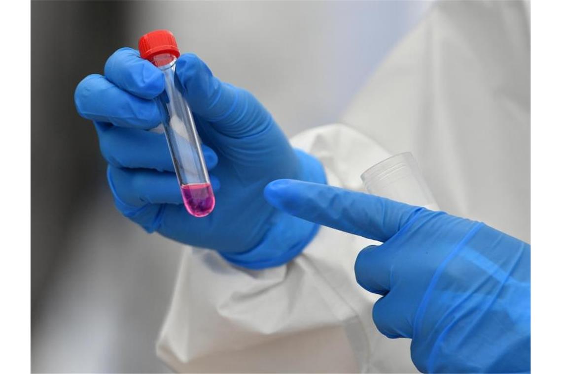 Klinikum Heidenheim: Sieben Angestellte mit Corona infiziert Eine Laborantin hält einen Corona-Test in der Hand. Foto: Hendrik Schmidt/dpa-Zentralbild/ZB/Archivbild