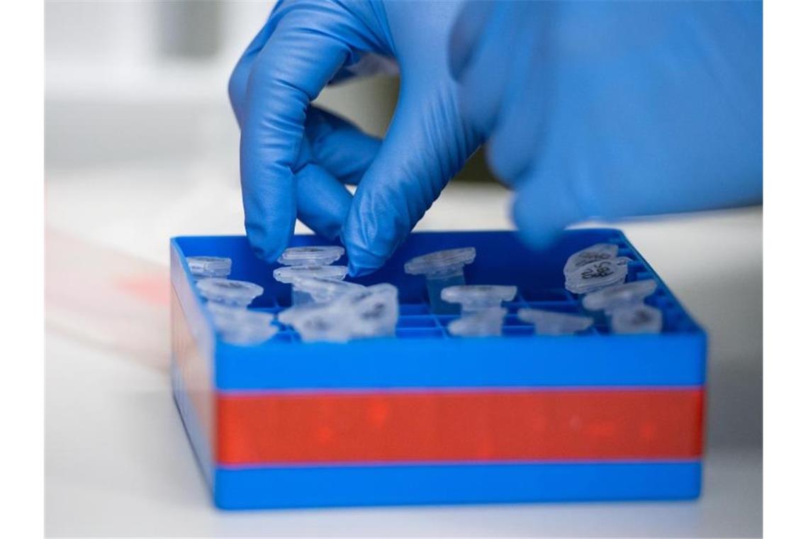 Zahl der Corona-Toten in Baden-Württemberg nimmt weiter zu Eine Laborantin sortiert im Institut für Virologie an der Charite Berlin Mitte, in dem Untersuchungen zum Coronavirus laufen, Proben. Foto: Christophe Gateau/dpa/Archivbild