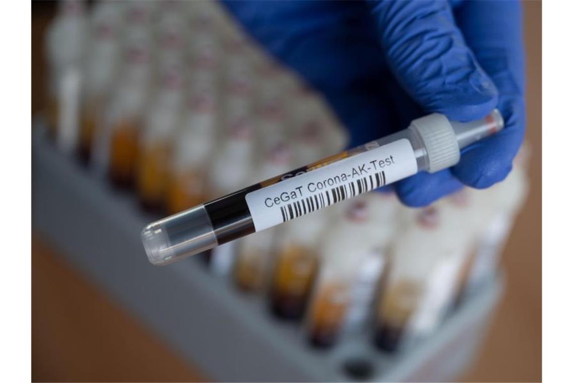 Eine Laborantin zeigt ein Röhrchen mit einer Blutprobe für einen Corona-Antikörper-Test. Foto: Marijan Murat/dpa
