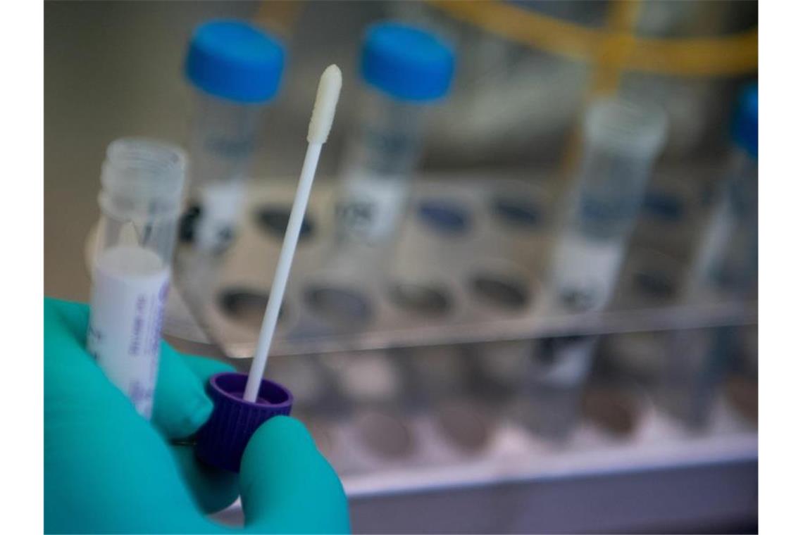 Coronavirus: Milde Verläufe bei bislang infizierten Menschen Eine Labormitarbeiterin hält einen Abstrich eines Covid-19 Verdachtsfalles in der Hand. Foto: Marijan Murat/dpa/Archivbild