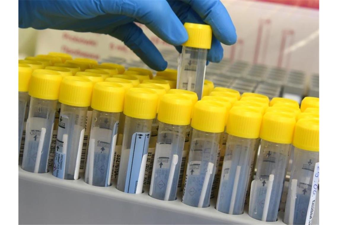 Land will PCR-Testkapazitäten in Apotheken ausbauen Eine medizinisch technische Laborassistentin bereitet die Bearbeitung von PCR-Tests vor. Foto: Waltraud Grubitzsch/dpa-Zentralbild/dpa/Symbolbild