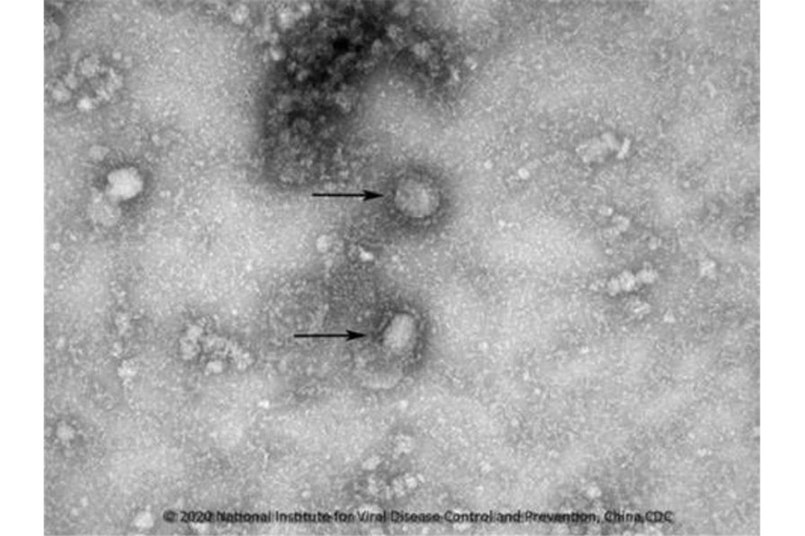 Bislang kein Nachweis des Coronavirus aus China Eine Mikroskopaufnahme zeigt den neuen Stamm des Coronavirus. Foto: IVDC/China CDC via GISAID/dpa/Archivbild