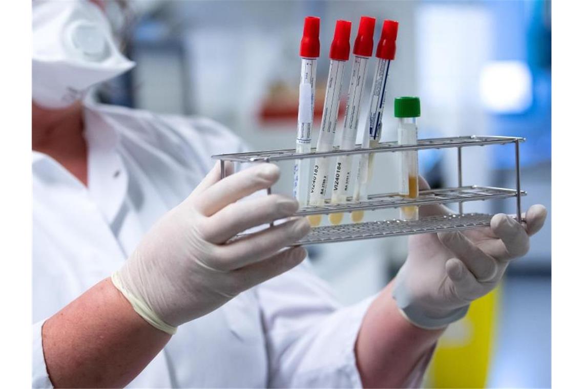 Verwirrung um Corona-Tests: Labor analysiert alle Proben Eine Mitarbeiterin bereitet Proben von Menschen mit Covid-19 Verdacht in einem Labor vor. Foto: Sven Hoppe/dpa/Archivbild