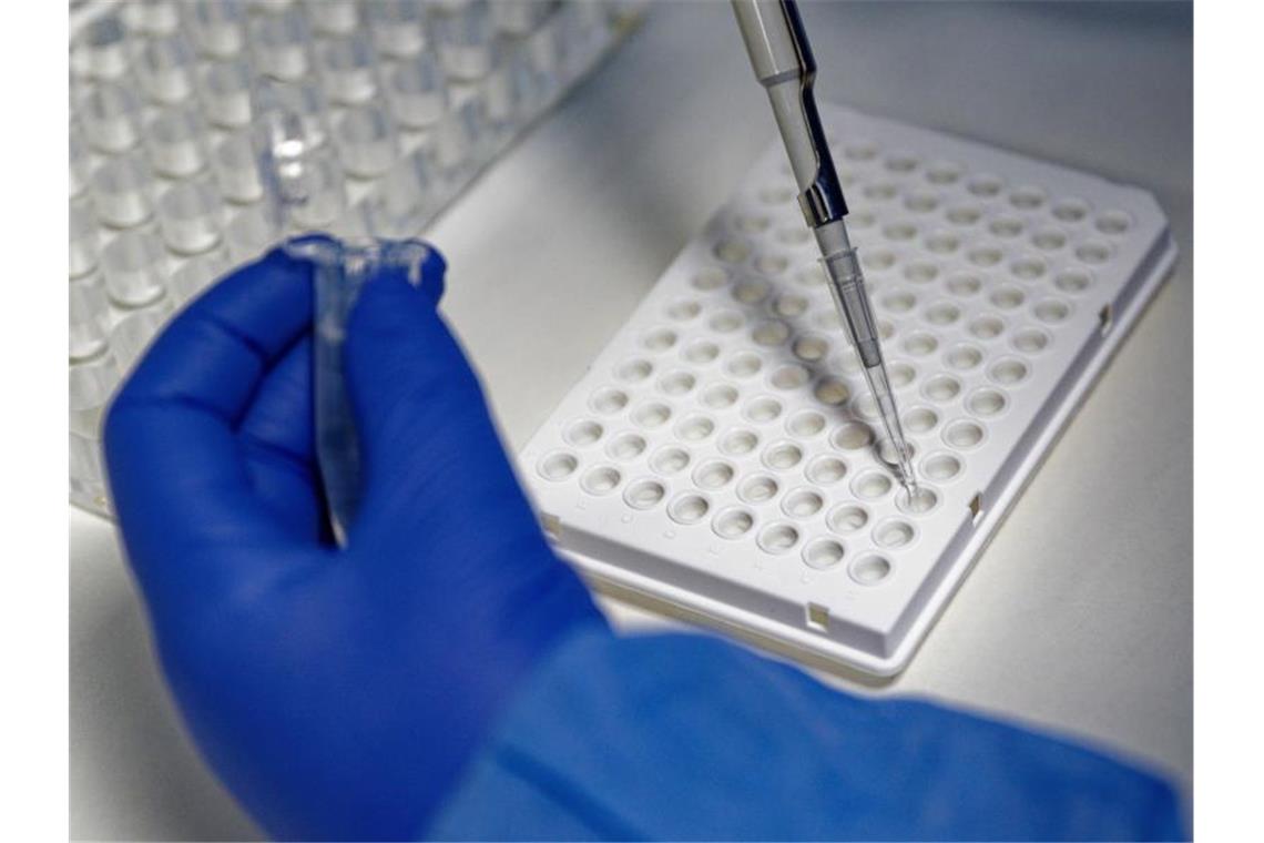 RKI meldet erneut niedrigere Inzidenz als am Vortag Eine Mitarbeiterin des Labors CBT in Bonn füllt zur Vorbereitung von PCR-Tests eine Testflüssigkeit in eine Trägerplatte. Foto: Henning Kaiser/dpa