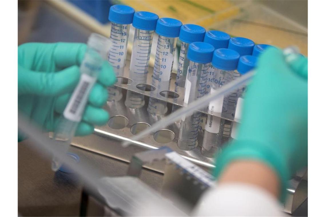 Corona-Lage in Deutschland stabilisiert sich Eine Mitarbeiterin des Landesgesundheitsamts Baden-Württemberg pipettiert Coronaproben. Foto: Marijan Murat/dpa