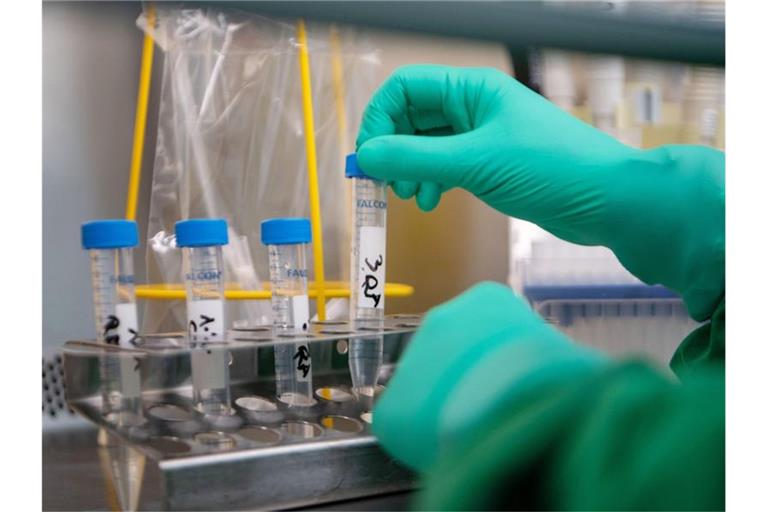Eine Mitarbeiterin des Landesgesundheitsamts in Stuttgart setzt eine Probe in eine Vorrichtung. Foto: Marijan Murat/dpa/Archivbild