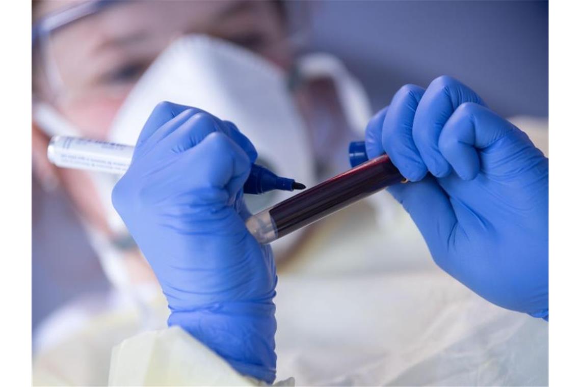 Eine Mitarbeiterin des Robert Koch-Instituts beschriftet eine Blutprobe für einen Antikörpertest (Symbol). Foto: Marijan Murat/dpa