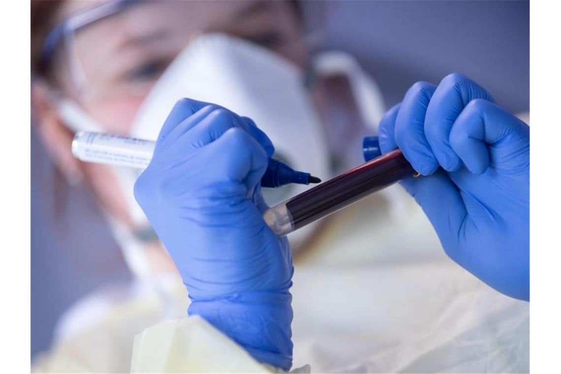 Eine Mitarbeiterin des Robert Koch-Instituts beschriftet eine Blutprobe für einen Antikörpertest. Foto: Marijan Murat/dpa