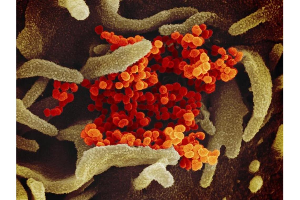 Eine rasterelektronenmikroskopische Aufnahme des Coronavirus. Foto: Uncredited/NIAID-RML/AP/dpa
