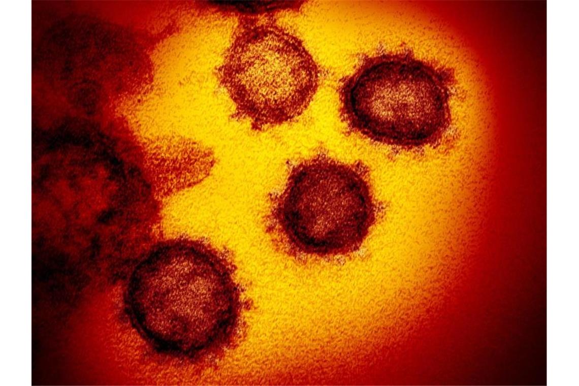 Eine undatierte elektronenmikroskopische Aufnahme des Coronavirus (SARS-CoV-2). Foto: NIAID-RML/AP/dpa/Archivbild