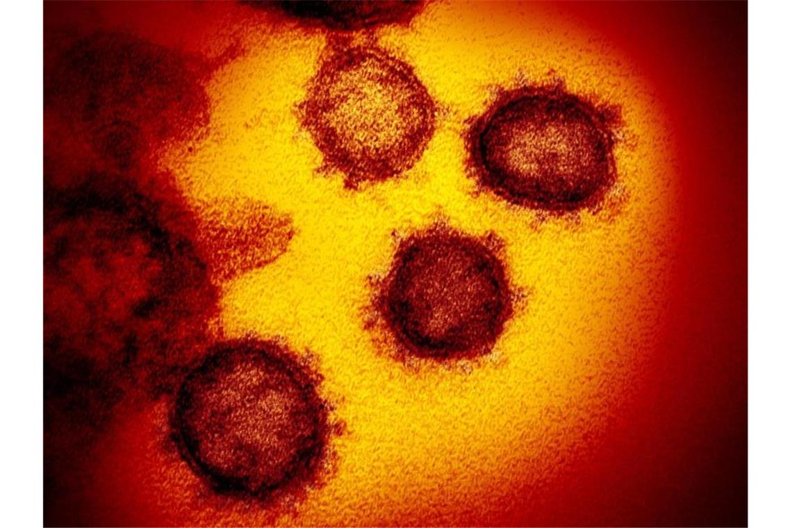 Eine undatierte elektronenmikroskopische Aufnahme zeigt das neuartige Coronavirus (SARS-CoV-2). Foto: ---/NIAID-RML/AP/dpa