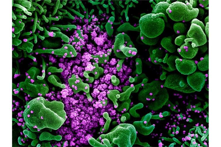 Eine Zelle (grün) ist mit dem Coronavirus (SARS-CoV-2, violett) infiziert. Foto: Niaid/Europa Press/dpa