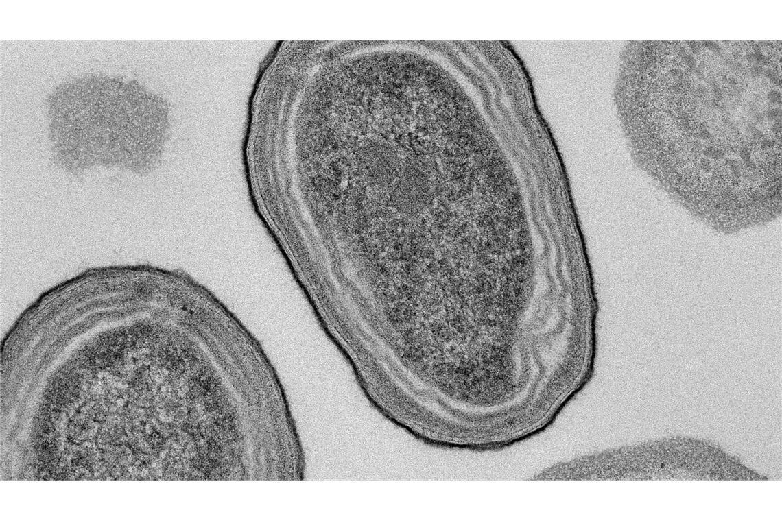 Klimakrise: Wohl häufigstem Organismus droht Extrem-Schwund Elektronenmikroskopische Aufnahme von Prochlorococcus-Zellen.