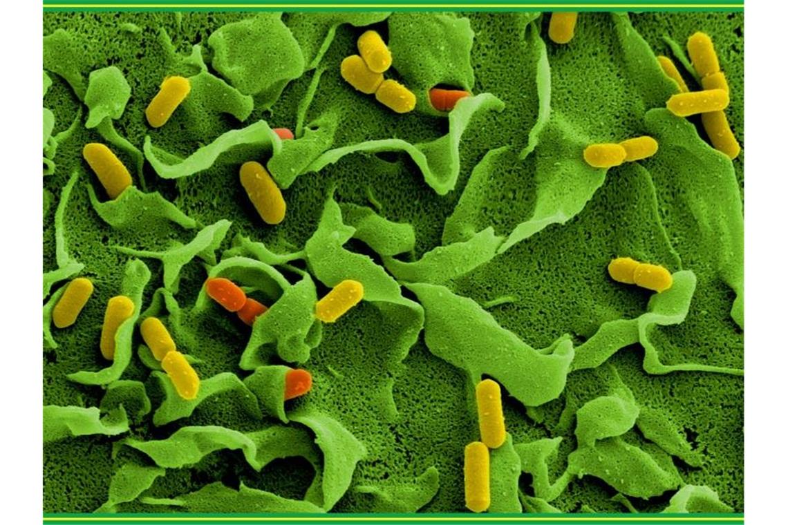 Elektronenmikroskopische Aufnahmen von Listerien (Listeria monocytogenes). Foto: Manfred Rohde/Helmholtz-Zentrum für Infektionsforschung/dpa