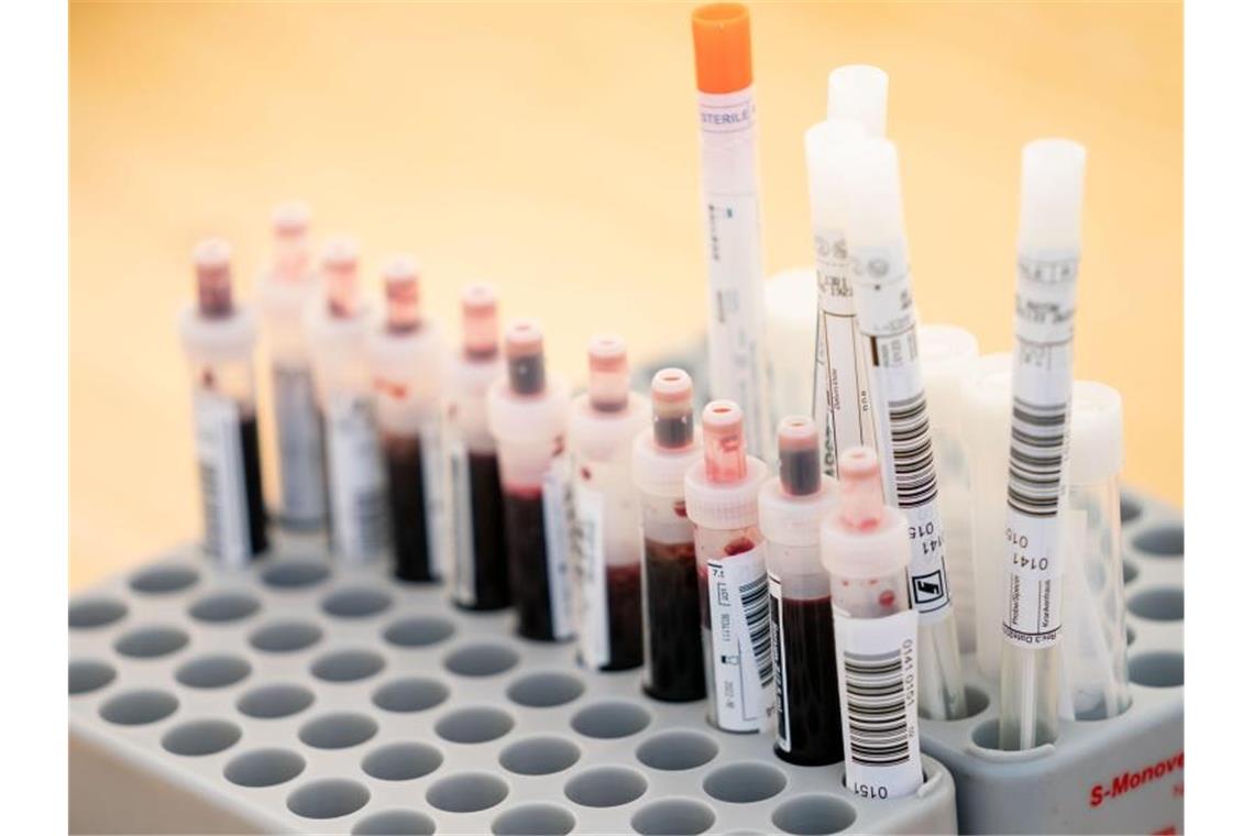 Lebensmittelfirma wegen Corona-Infektionen unter Quarantäne Entnommene Abstrichtests und Blutproben. Foto: Kay Nietfeld/dpa