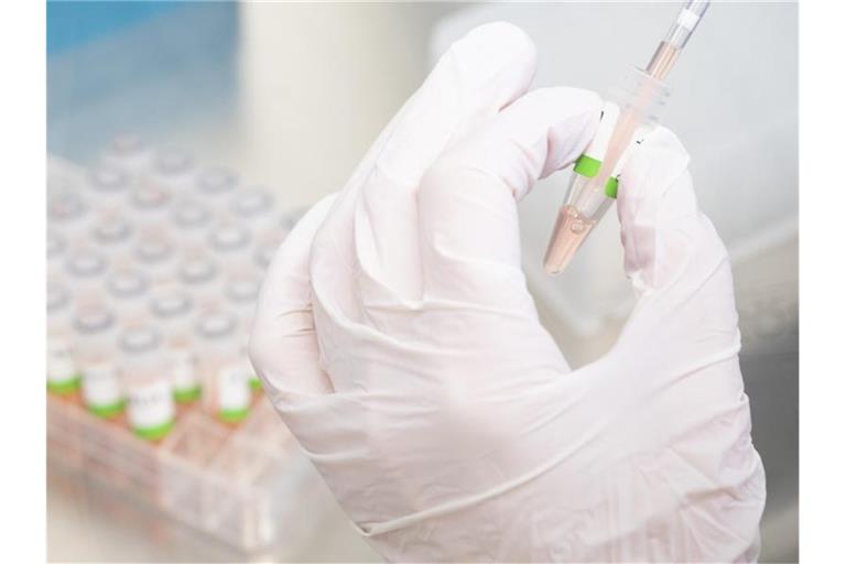Es wird vermutet, dass viele Menschen ihre Infektion nicht mehr über einen PCR-Test bestätigen lassen. Foto: Julian Stratenschulte/dpa