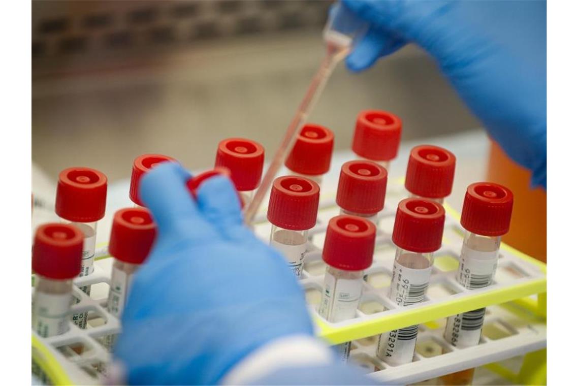 USA: Klinischer Test für Coronavirus-Impfstoff gestartet