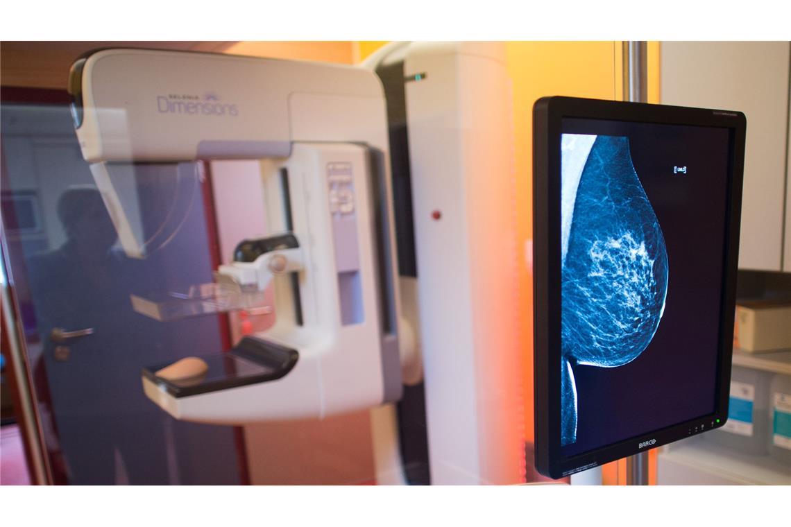 Mammografie-Screening senkt Brustkrebs-Sterblichkeit Etwa 18.500 Frauen jährlich sterben an Brustkrebs - ohne Mammographie-Screening-Programm wären es Schätzungen zufolge mehrere Tausend mehr. (Archivbild)