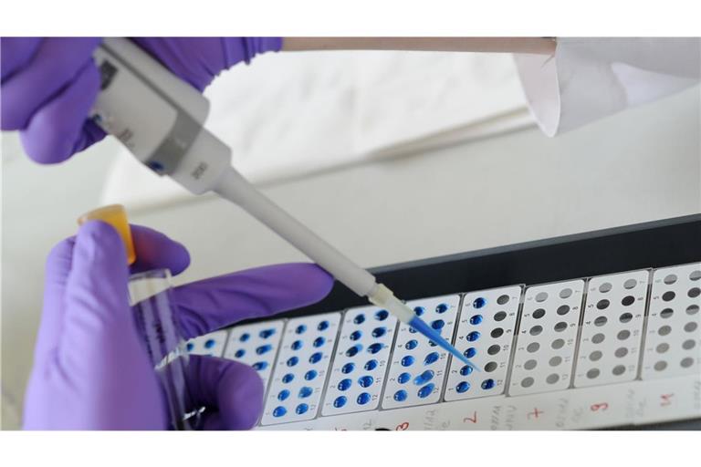 Experten in Baden-Württemberg haben sich zu dem Hantavirus geäußert. (Symbolbild)
