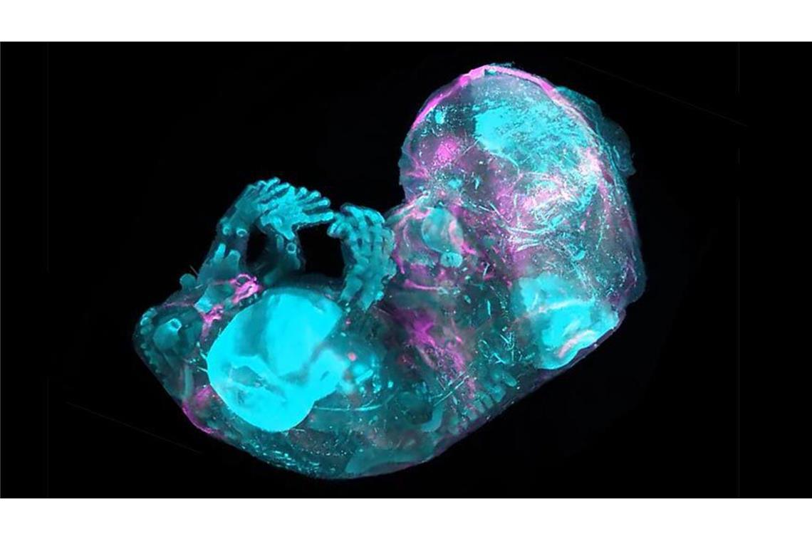 Wie die Knochen des ungeborenen Kindes entstehen Forscher haben bis auf die Zellebene entschlüsselt, wie das Skelett eines menschlichen Embryos entsteht und wächst.