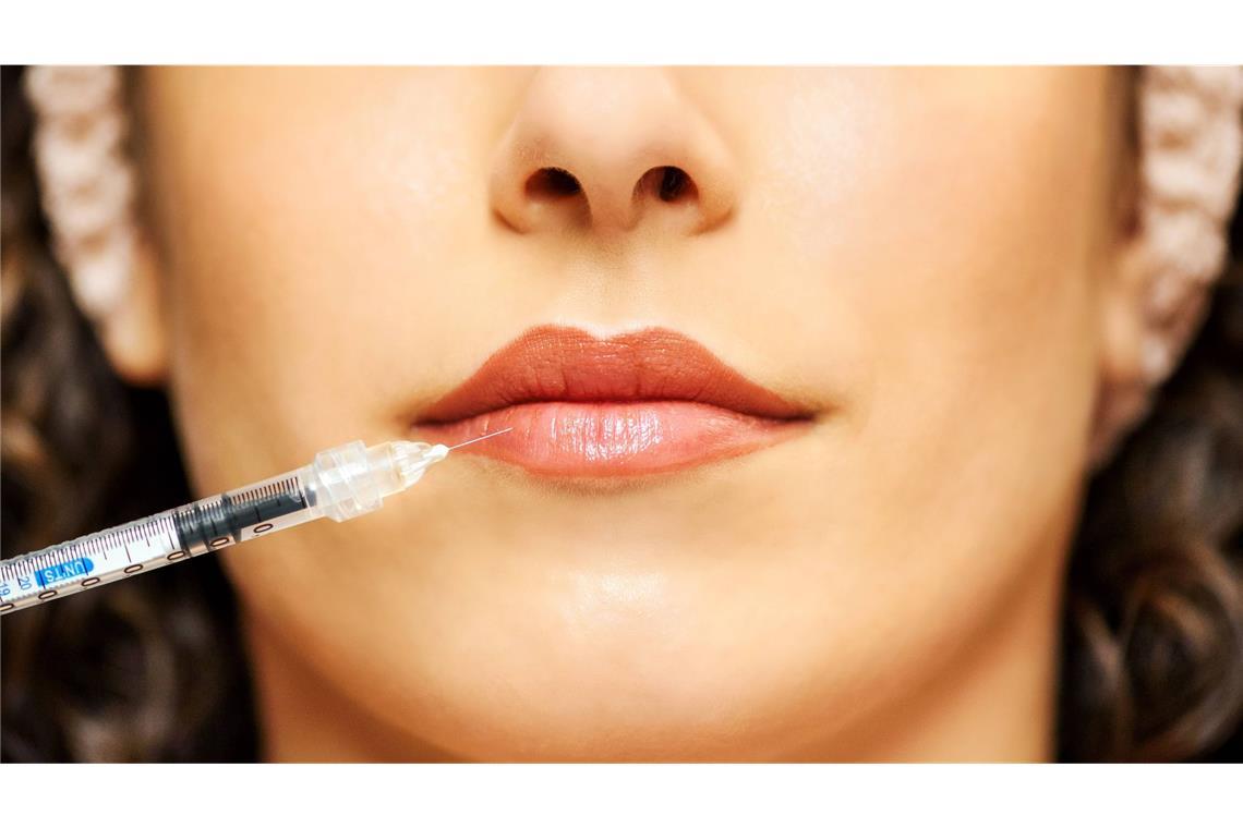 BGH: Keine Vorher-Nachher-Werbung für Hyaluron-Spritzung Für minimalinvasive Schönheitseingriffe dürfen Unternehmen nicht mit Vorher-Nachher-Bildern werben. (Symbolbild)