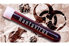 Hantavirus-Untersuchung im Labor (Montage/Symbolbild).