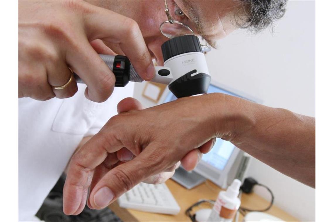 ILLUSTRATION - Ein Hautarzt untersucht in seiner Praxis mit einem Vergrößerungsglas die Haut einer Patientin bei einer Hautkrebs-Früherkennung. Foto: Karl-Josef Hildenbrand/dpa