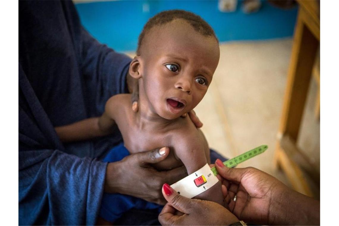 Im Gesundheitszentrum von Gao (Mali) wird der arm eines schwer unterernährten, 16 Monate alten Kindes vermessen. Foto: Dicko/Unicef/dpa