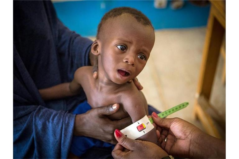 Im Gesundheitszentrum von Gao (Mali) wird der arm eines schwer unterernährten, 16 Monate alten Kindes vermessen. Foto: Dicko/Unicef/dpa