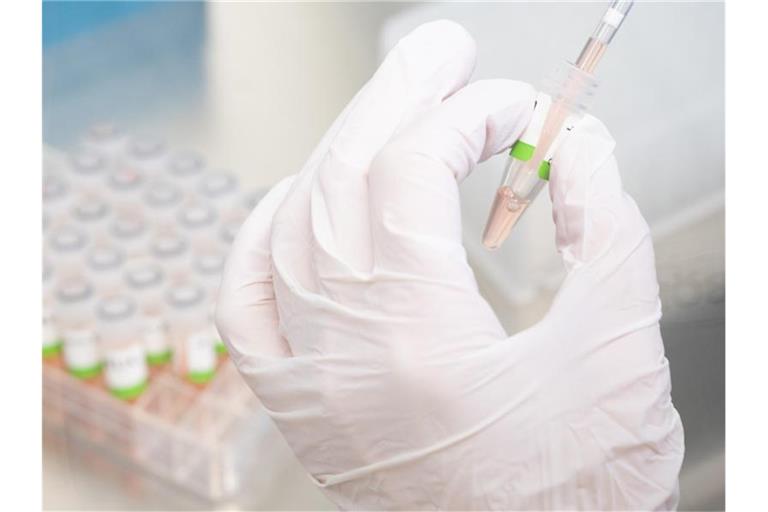 Im Labor wird ein PCR-Test auf das Coronavirus vorbereitet. Foto: Julian Stratenschulte/dpa