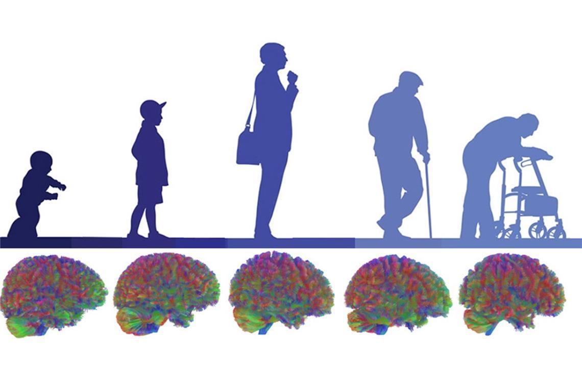 Im Laufe unseres Lebens durchläuft unsere Hirnstruktur fünf Phasen.