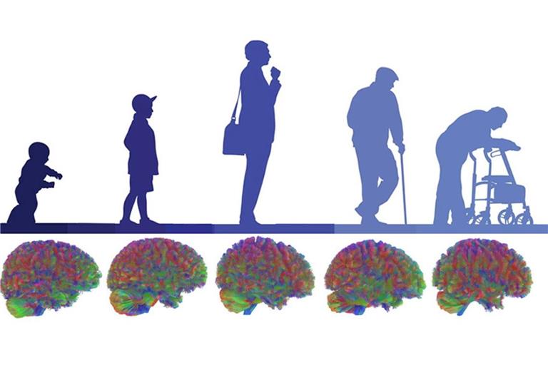 Im Laufe unseres Lebens durchläuft unsere Hirnstruktur fünf Phasen.