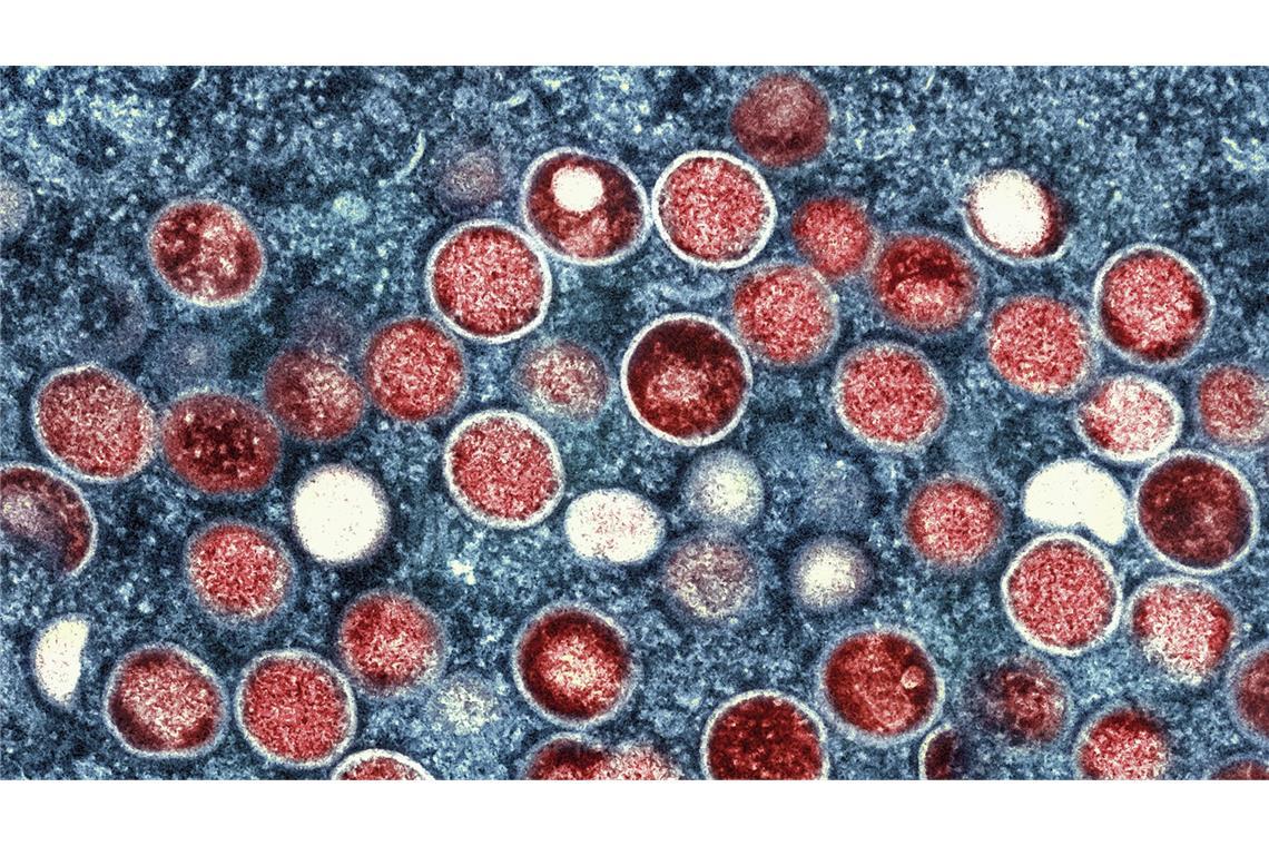 Ungewöhnlich viele Mpox-Fälle gemeldet In Berlin wurden viele Mpox-Fälle gemeldet.