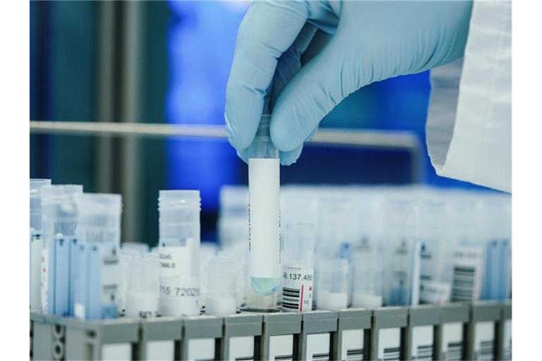 In den Laboren werden zurzeit so viele PCR-Tests gemacht wie noch nie. Foto: Uwe Anspach/dpa