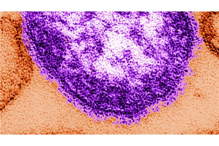 In den USA wurden seit Anfang des Jahres fast 1000 Masern-Fälle gemeldet.