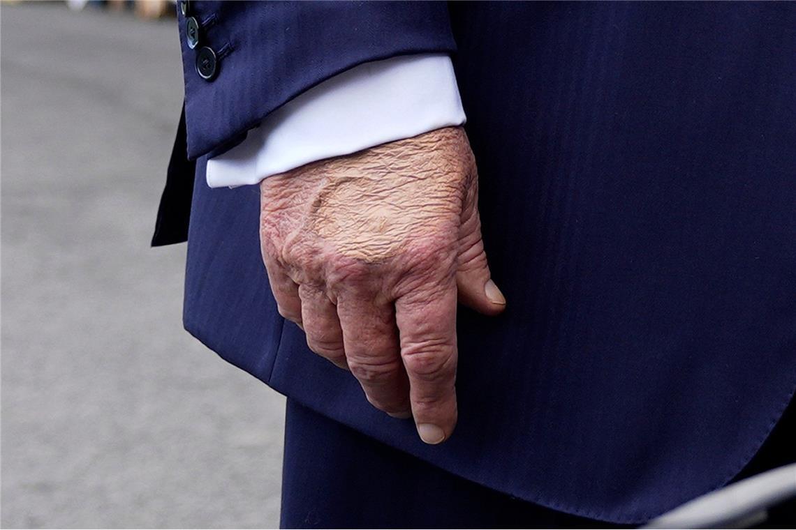 In den vergangenen Tagen hatten Medien über Blutergüsse an einer Hand Trumps und über Schwellungen an seinen Beinen spekuliert.